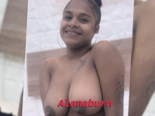 Alanaburn